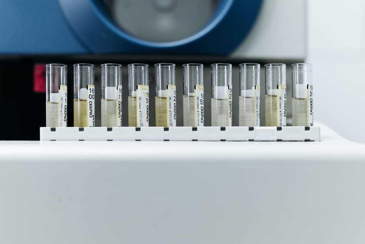 Colorimetric test strips being compared against a reference chart